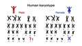 Normal human karyotype chromosome, Human karyotype and chromosome structure, Sex chromosome structure, Male and Female Royalty Free Stock Photo